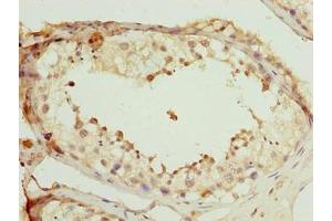 Immunohistochemistry of paraffin-embedded human testis tissue using ABIN7168517 at dilution of 1:100 (SCAPER Antikörper  (AA 1109-1400))