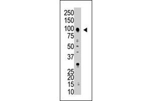 The USP5 polyclonal antibody  is used in Western blot to detect USP5 in HL-60 cell lysate . (USP5 Antikörper  (AA 59-90))