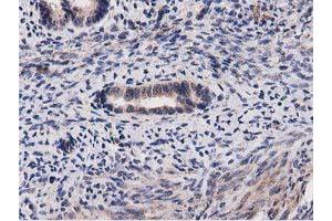 Image no. 9 for anti-Acyl-CoA Thioesterase 12 (ACOT12) antibody (ABIN1496414) (ACOT12 Antikörper)