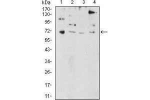 Western Blotting (WB) image for anti-PR Domain Containing 5 (PRDM5) (AA 1-100) antibody (ABIN5874500) (PRDM5 Antikörper  (AA 1-100))
