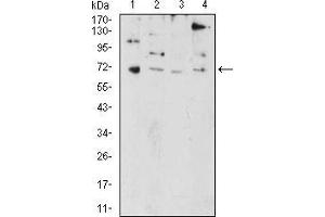 Western Blotting (WB) image for anti-PR Domain Containing 5 (PRDM5) (AA 1-100) antibody (ABIN5874500) (PRDM5 Antikörper  (AA 1-100))