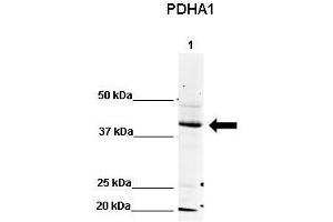 WB Suggested Anti-PDHA1 Antibody    Positive Control:  Lane 1: 80ug mouse brain extract   Primary Antibody Dilution :   1:500  Secondary Antibody :  IRDye 800 CW goat anti-rabbit from Li-COR Bioscience  Secondry Antibody Dilution :   1:20,000  Submitted by:  Dr. (PDHA1 Antikörper  (N-Term))