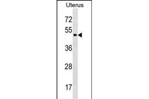 PLA2G3 Antibody (C-term) (ABIN1537347 and ABIN2850277) western blot analysis in Uterus tissue lysates (35 μg/lane). (PLA2G3 Antikörper  (C-Term))
