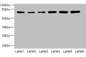 Western blot All lanes: ZNF555 antibody at 2 μg/mL Lane 1: HepG2 whole cell lysate Lane 2: 293T whole cell lysate Lane 3: Hela whole cell lysate Lane 4: Jurkat whole cell lysate Lane 5: Mouse liver tissue Lane 6: HL60 whole cell lysate Secondary Goat polyclonal to rabbit IgG at 1/10000 dilution Predicted band size: 74, 64, 73 kDa Observed band size: 74 kDa (ZNF555 Antikörper  (AA 1-200))