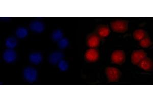 IF analysis of MSH2 using anti-MSH2 antibody (ABIN7601369). (MSH2 Antikörper  (AA 337-583))