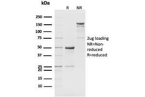 SDS-PAGE Analysis Purified CD8b Rat Monoclonal Antibody (H35-17. (CD8B Antikörper)