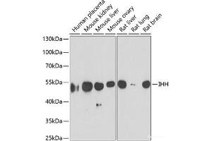 Western blot analysis of extracts of various cell lines using IHH Polyclonal Antibody at dilution of 1:1000. (Indian Hedgehog Antikörper)