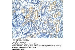Human kidney (IRF8 Antikörper  (N-Term))