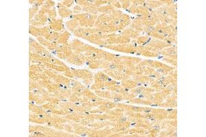 Immunohistochemistry of paraffin embedded mouse heart using Junctophilin2 (ABIN7074393) at dilution of 1: 600 (400x lens) (Junctophilin 2 Antikörper)