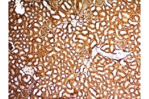 IHC testing of FFPE mouse kidney with WT1 antibody. (WT1 Antikörper)