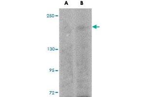 Western blot analysis of SIPA1L1 in rat brain tissue lysate with SIPA1L1 polyclonal antibody  at (A) 0.