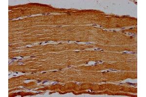 IHC image of ABIN7142671 diluted at 1:30 and staining in paraffin-embedded human skeletal muscle tissue performed on a Leica BondTM system. (CD73 Antikörper  (AA 32-264))
