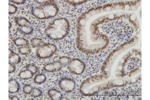 Immunoperoxidase of monoclonal antibody to SP1 on formalin-fixed paraffin-embedded human small Intestine. (SP1 Antikörper  (AA 89-198))