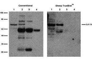 Sheep TrueBlot® IP / Western Blot: Jurkat cell lysate (500 µg) was incubated with 2 µg of sheep anti-SLP76 and immunoprecipitated using Protein G. (Schaf TrueBlot® Anti-Schaf IgG HRP)