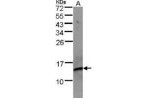 WB Image Sample(30 μg of whole cell lysate) A:Raji , 15% SDS PAGE antibody diluted at 1:500 (beta-2 Microglobulin Antikörper)