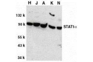 Western blot analysis of STAT1 alpha in whole cell lysates from HeLa (H), Jurkat (J), A431 (A), K562 (K), and NIH3T3 (N) cells, with this product at 1 μg/ml. (STAT1 Antikörper  (C-Term))