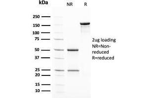 SDS-PAGE Analysis Purified Insulin Mouse Monoclonal Antibody (2D11-H5).