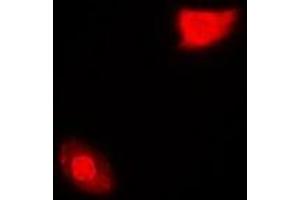 Immunofluorescent analysis of SGTA staining in MCF7 cells. (SGTA Antikörper)