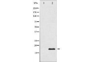 Western blot analysis of Acetyl-Histone H3 phosphorylation expression in TSA treated RAW264. (Histone 3 Antikörper  (H3K9ac))