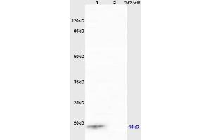 Lane 1: human colon carcinoma lysates Lane 2: mouse intestine lysates probed with Anti IQCJ Polyclonal Antibody, Unconjugated (ABIN1387803) at 1:200 in 4 °C. (IQCJ Antikörper  (AA 47-67))