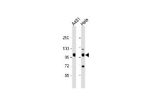 Western Blotting (WB) image for anti-Insulin-Like Growth Factor 1 Receptor (IGF1R) (AA 1335-1366), (C-Term) antibody (ABIN6242851)