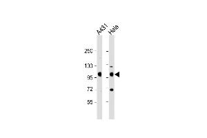 All lanes : Anti-IGF1 Receptor (IGF1R) Antibody (C-term) at 1:2000 dilution Lane 1: A431 whole cell lysate Lane 2: Hela whole cell lysate Lysates/proteins at 20 μg per lane. (IGF1R Antikörper  (C-Term))