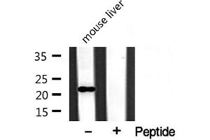 Western blot analysis of extracts from mouse liver, using BST2 antibody. (BST2 Antikörper  (Internal Region))