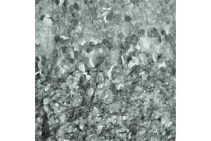 IHC on mouse brain (cryo section) using Rabbit antibody to Synaptotagmin 17  at a concentration of 50 µg/ml incubated overnight at 4C. (SYT17 Antikörper  (Internal Region))