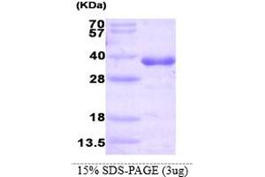 HNMT Protein (AA 1-292) (His tag)