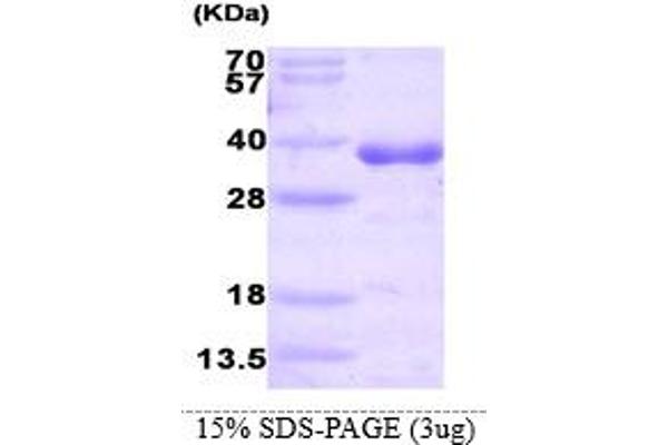 HNMT Protein (AA 1-292) (His tag)