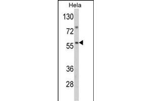 Western blot analysis of SARS2 Antibody (Center) (ABIN392301 and ABIN2841955) in Hela cell line lysates (35 μg/lane).