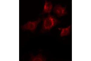 ABIN6268794 staining Hela by IF/ICC. (EPH Receptor B2 Antikörper  (C-Term))