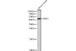 RGS5 Antikörper  (AA 1-181)