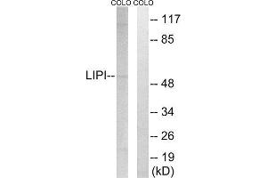 Western Blotting (WB) image for anti-Lipase I (LIPI) (Internal Region) antibody (ABIN1851490) (Lipase I Antikörper  (Internal Region))