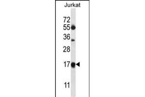MRPL41 Antibody (N-term) (ABIN657049 and ABIN2846216) western blot analysis in Jurkat cell line lysates (35 μg/lane). (MRPL41 Antikörper  (N-Term))
