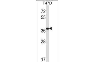Western Blotting (WB) image for anti-Protein Phosphatase 2, Catalytic Subunit, beta Isozyme (PPP2CB) (AA 278-307), (C-Term) antibody (ABIN657687)