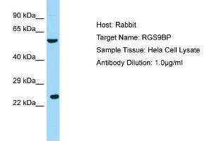 Host: RabbitTarget Name: RGS9BPAntibody Dilution: 1. (Regulator of G Protein Signaling 9 Binding Protein (RGS9BP) (N-Term) Antikörper)