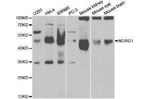 Western blot analysis of extracts of various cell lines, using NDRG1 antibody. (NDRG1 Antikörper  (AA 175-394))