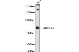 Western blot analysis of extracts of HeLa cells, using Caldesmon antibody (ABIN7266024) at 1:1000 dilution. (Caldesmon Antikörper)