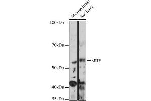 Western blot analysis of extracts of various cell lines, using MITF Rabbit mAb (ABIN7268511) at 1:1000 dilution. (MITF Antikörper)