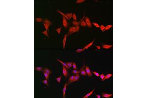Immunofluorescence analysis of NIH-3T3 cells using TRIM31 Rabbit pAb (ABIN7270987) at dilution of 1:200 (40x lens). (TRIM31 Antikörper  (AA 186-425))