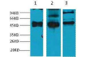 Western Blotting (WB) image for anti-Keratin 17 (KRT17) antibody (ABIN3178634) (KRT17 Antikörper)