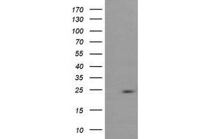 Image no. 2 for anti-RAB37, Member RAS Oncogene Family (RAB37) antibody (ABIN1500565) (RAB37 Antikörper)