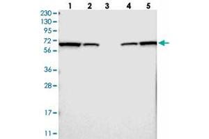Western blot analysis of Lane 1: RT-4, Lane 2: U-251 MG, Lane 3: Human Plasma, Lane 4: Liver, Lane 5: Tonsil with LTA4H polyclonal antibody  at 1:250-1:500 dilution. (LTA4H Antikörper)