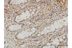 Immunostaining (ISt) image for anti-Microtubule-Associated Protein, RP/EB Family, Member 2 (MAPRE2) (AA 1-62) antibody (ABIN564763)