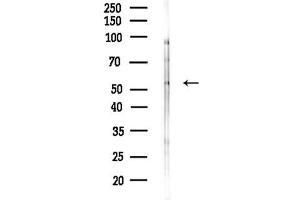 anti-Coiled-Coil Domain Containing 102B (CCDC102B) (Internal Region) antibody