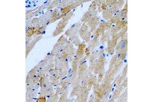 Immunohistochemical analysis of TTLL12 staining in rat heart formalin fixed paraffin embedded tissue section. (TTLL12 Antikörper)