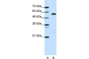 WB Suggested Anti-CORO1A Antibody Titration:  0. (Coronin 1a Antikörper  (Middle Region))