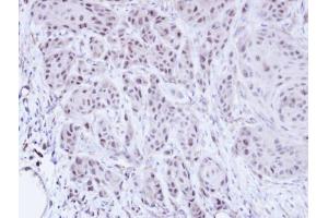 IHC-P Image Immunohistochemical analysis of paraffin-embedded Cal27 xenograft, using SCMH1, antibody at 1:100 dilution.