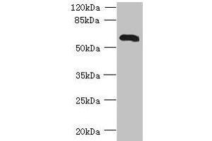 Western blot All lanes: USP30 antibody at 7 μg/mL + Mouse liver tissue Secondary Goat polyclonal to rabbit IgG at 1/10000 dilution Predicted band size: 59 kDa Observed band size: 59 kDa (USP3 Antikörper  (C-Term))